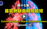 第十七集 器官热缺血时间超短 第十七集 器官热缺血时间超短